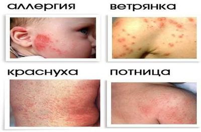 allergiyanalekrastva