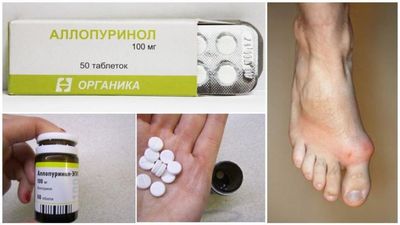 аллопуринол
