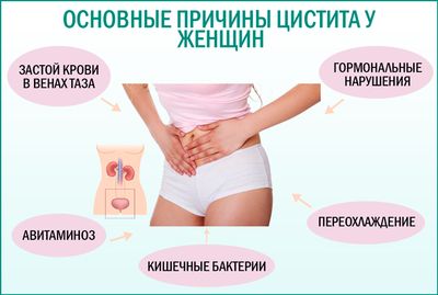 Цистит: основные причины