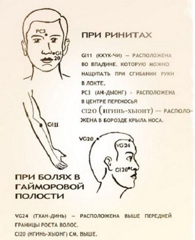 При насморке лекарством массируют определенные точки