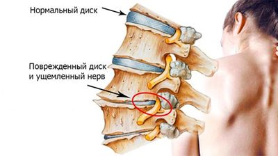 Позвоночник
