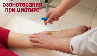 озонотерапия