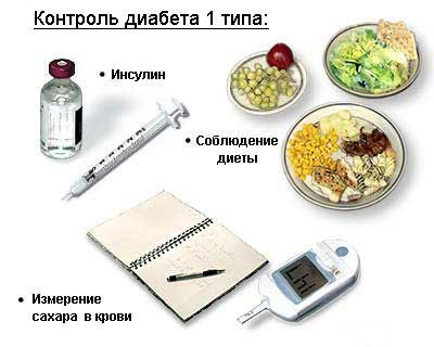 Контроль диабета 1 типа