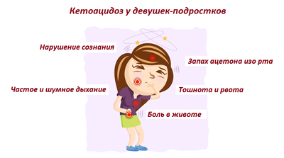 кетоацидоз у девушек