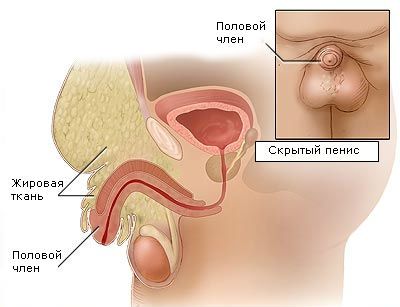 маленький половой член
