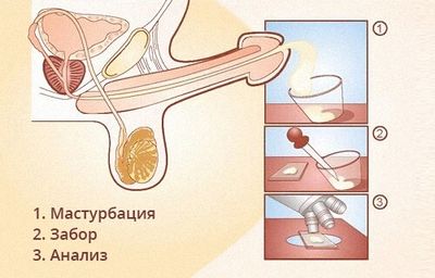 анализ спермы