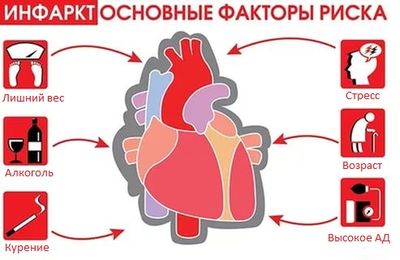 Причины инфаркта миокарда