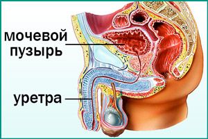 Мужской цистит: домашние способы лечения