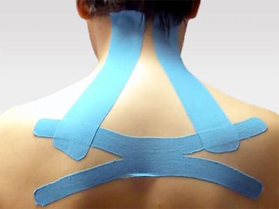 Применение кинезио тейп в спорте и медицине