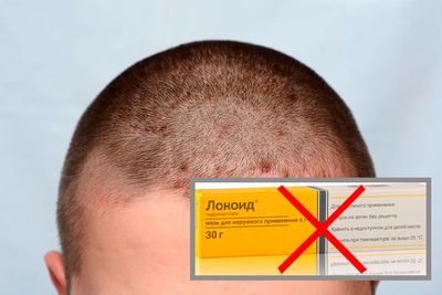От чего помогает мазь Локоид - инструкция и аналоги