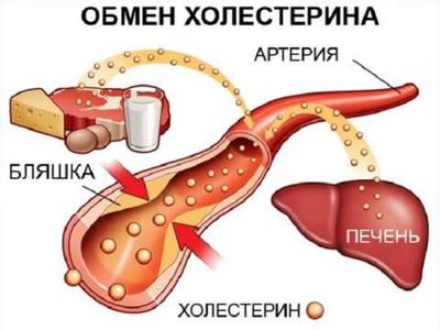 Холестерин в сосудах