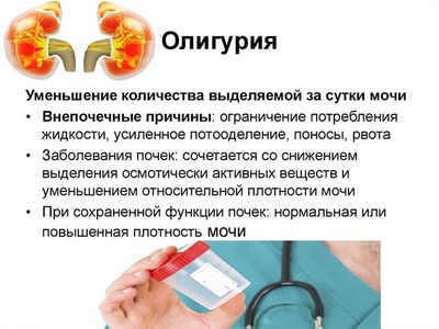 олигурия