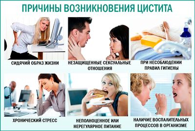 Цистит у женщин: причины появления