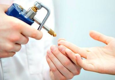 posle-udaleniya