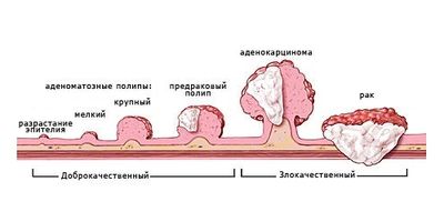 виды полипов