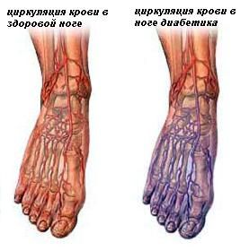 Последствия нарушения циркуляции крови