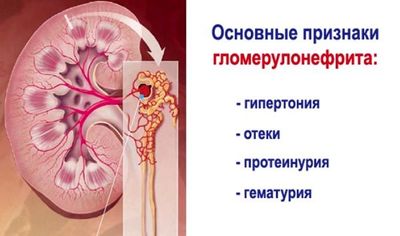 симптомы гломерулонефрита