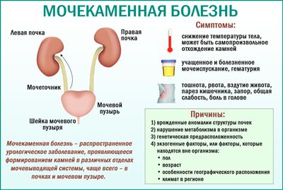 Мочекаменная болезнь и современные методы лечения