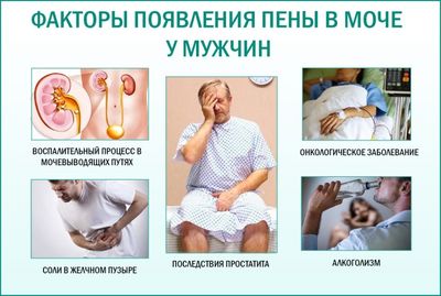 Пена в моче у мужчин