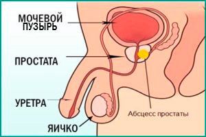 Простата у мужчин