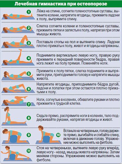 гимнастика при остеопорозе