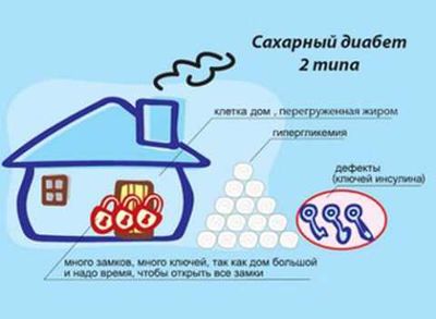 Механизм развития СД-2 другой