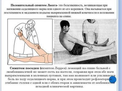 Симптомы Ласега и Леррея