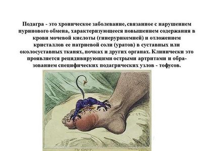 О подагре