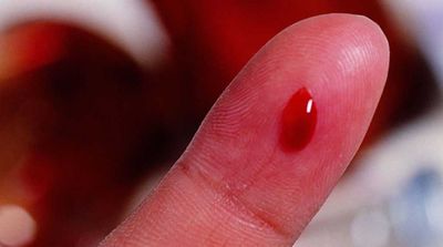 Определение уровня сахара в крови