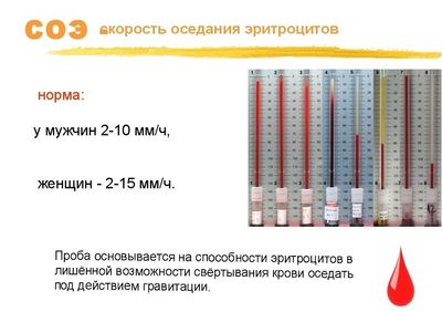 Норма СОЭ в крови у женщин