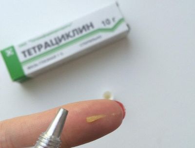 Мазь выпускается в алюминиевых тюбиках