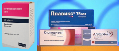 Длительный приём препаратов, разжижающих кровь – важная составляющая терапии аритмии предсердий