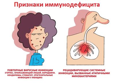 иммунодефицит