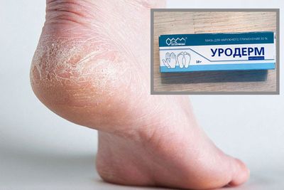 Инструкция по применению мази Уродерм