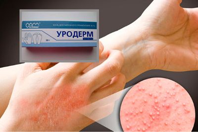 Инструкция по применению мази Уродерм