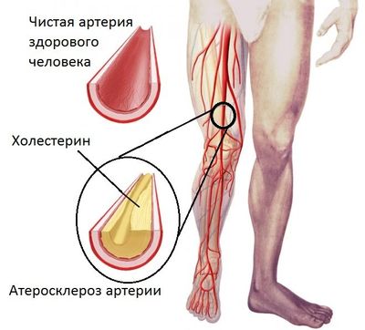 Показания и методы проведения УЗИ и УЗДГ сосудов ног
