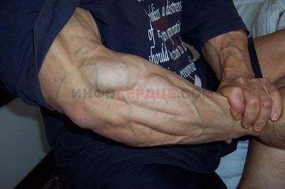 Выступающие вены у юодибилдеров