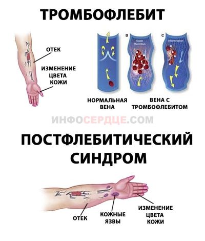 Патологии