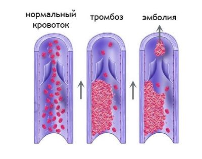 Показания к применению