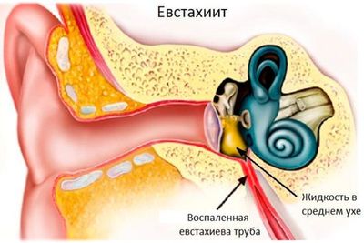 Евстахиит