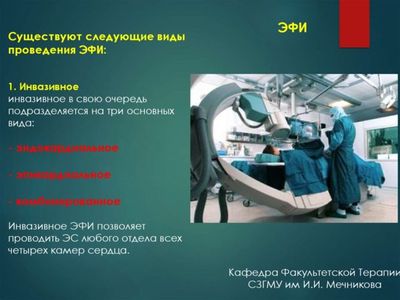 Что такое ЭФИ и ЧПЭС сердца и как проводятся исследования?