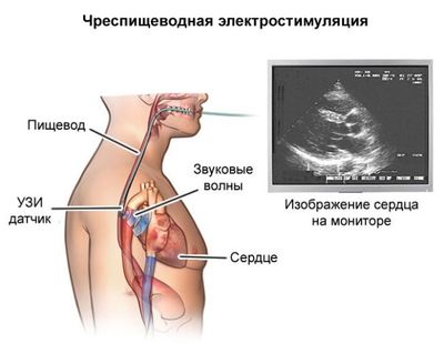 Виды