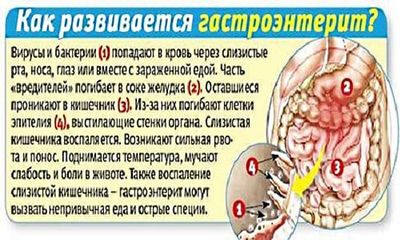 Гастроэнтерит