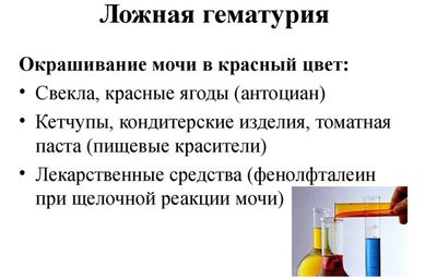Ложная гематурия