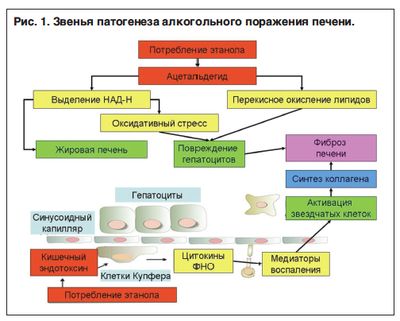 Патогенез алкогольного поражения печени