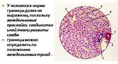 Асцит