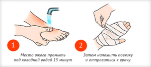 Что нужно делать при химическом ожоге