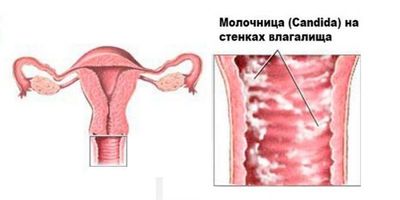 Почему в моче появляются хлопья, опасно ли это?