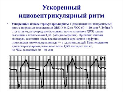 Ускоренный ИВР