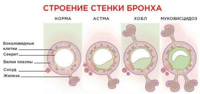 причины возникновения кашля